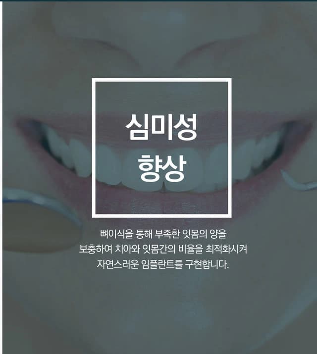 심미성 향상