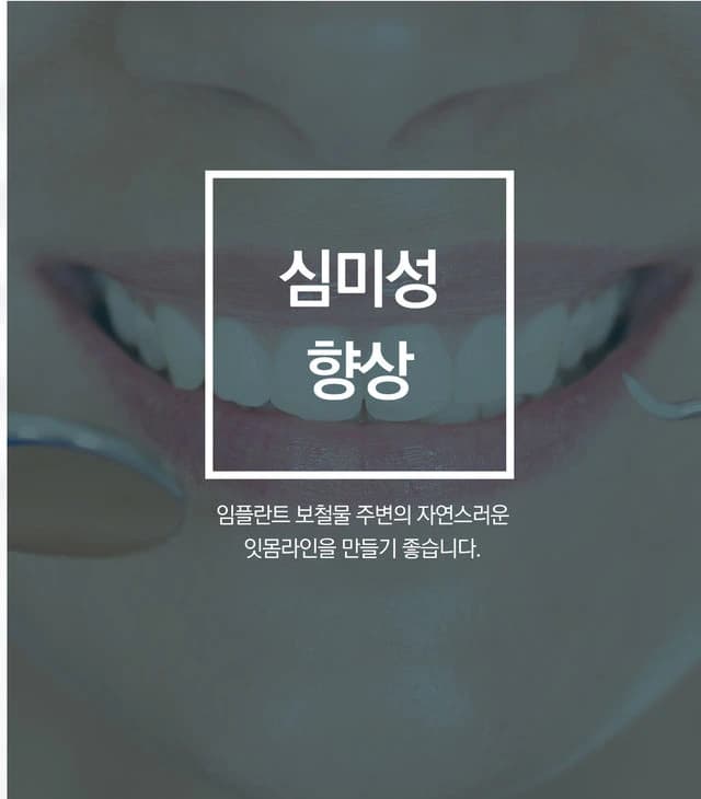 심미성 향상